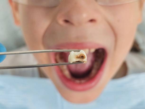 Best Walk-In Emergency Dentist in Dublin, TX